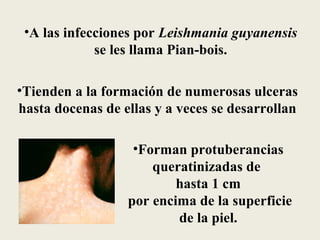 •A las infecciones por Leishmania guyanensis
             se les llama Pian-bois.

•Tienden a la formación de numerosas ulceras
hasta docenas de ellas y a veces se desarrollan

                   •Forman protuberancias
                      queratinizadas de
                          hasta 1 cm
                  por encima de la superficie
                          de la piel.
 