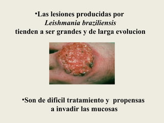 •Las lesiones producidas por
          Leishmania braziliensis
tienden a ser grandes y de larga evolucion




  •Son de dificil tratamiento y propensas
           a invadir las mucosas
 