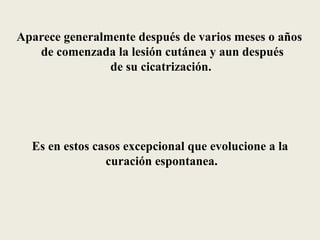 Aparece generalmente después de varios meses o años
   de comenzada la lesión cutánea y aun después
                de su cicatrización.




  Es en estos casos excepcional que evolucione a la
                curación espontanea.
 