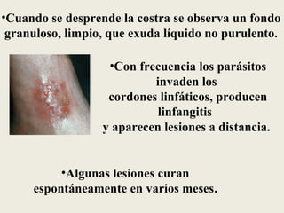 •Cuando se desprende la costra se observa un fondo
 granuloso, limpio, que exuda líquido no purulento.

                   •Con frecuencia los parásitos
                           invaden los
                   cordones linfáticos, producen
                            linfangitis
                  y aparecen lesiones a distancia.


          •Algunas lesiones curan
     espontáneamente en varios meses.
 