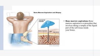 • Bone marrow aspirations-Bone
marrow aspiration is a procedure that
involves taking a sample of the liquid
part of the soft tissue inside
your bones.
 
