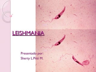 LEISHMANIA


  Presentado por:
  Sherty L.Pittí M.
 