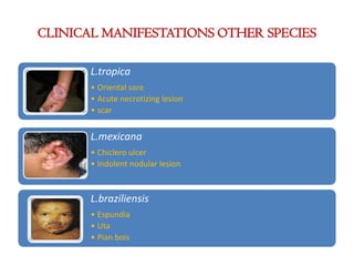 CLINICAL MANIFESTATIONS OTHER SPECIES
L.tropica
• Oriental sore
• Acute necrotizing lesion
• scar
L.mexicana
• Chiclero ulcer
• Indolent nodular lesion
L.braziliensis
• Espundia
• Uta
• Pian bois
 