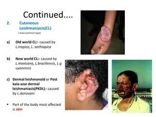 Continued....
2. Cutaneous
Leishmaniasis(CL)
( most common type)
a) Old world CL:- caused by
L.tropica, L. aethiopica
b) New world CL:- caused by
L.mexicana, L.braziliensis, L.g
uyanensis
c) Dermal leishmanoid or Post
kala-azar dermal
leishmaniasis(PKDL):- caused
by L.donovani
 Part of the body most affected
is skin
 