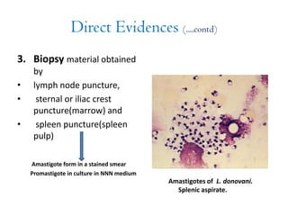 Direct Evidences (....contd)
3. Biopsy material obtained
by
• lymph node puncture,
• sternal or iliac crest
puncture(marrow) and
• spleen puncture(spleen
pulp)
Amastigote form in a stained smear
Promastigote in culture in NNN medium
Amastigotes of L. donovani.
Splenic aspirate.
 