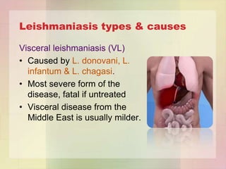 Leishmaniasis types & causes

Visceral leishmaniasis (VL)
• Caused by L. donovani, L.
  infantum & L. chagasi.
• Most severe form of the
  disease, fatal if untreated
• Visceral disease from the
  Middle East is usually milder.
 