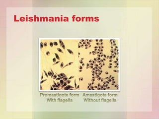Leishmania forms
 