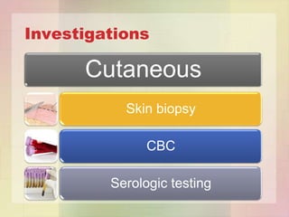 Investigations

      Cutaneous
           Skin biopsy

               CBC

         Serologic testing
 