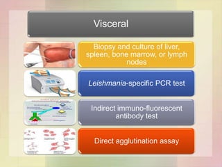Visceral

  Biopsy and culture of liver,
spleen, bone marrow, or lymph
            nodes

Leishmania-specific PCR test


 Indirect immuno-fluorescent
         antibody test


  Direct agglutination assay
 