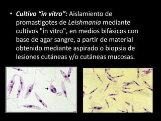 • Cultivo “in vitro”: Aislamiento de
promastigotes de Leishmania mediante
cultivos "in vitro", en medios bifásicos con
base de agar sangre, a partir de material
obtenido mediante aspirado o biopsia de
lesiones cutáneas y/o cutáneas mucosas.
 