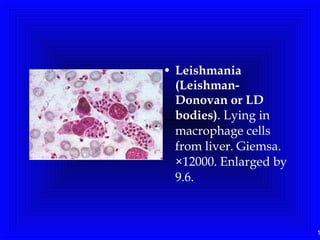 1
• Leishmania
(Leishman-
Donovan or LD
bodies). Lying in
macrophage cells
from liver. Giemsa.
×12000. Enlarged by
9.6.
 