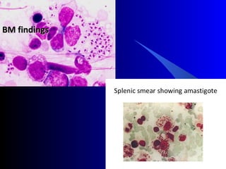 BM findingsBM findings
 