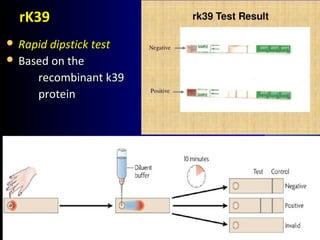 rK39rK39
 Rapid dipstick testRapid dipstick test
 Based on theBased on the
recombinant k39recombinant k39
proteinprotein
 