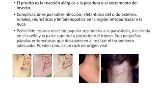 • El prurito es la reacción alérgica a la picadura o al excremento del
insecto.
• Complicaciones por sobreinfección: elefantiasis del oído externo,
renales, reumáticas y linfadenopatias en la región retroauricular y la
nuca
• Pedicúlide: es una reacción papular secundaria a la parasitosis, localizada
en el cuello y la parte superior y posterior del tronco. Son pequeñas
pápulas eritematosas que desaparecen al realizar el tratamiento
adecuado. Pueden simular un rash de origen viral.
 
