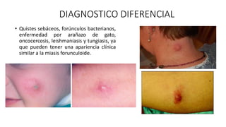DIAGNOSTICO DIFERENCIAL
• Quistes sebáceos, forúnculos bacterianos,
enfermedad por arañazo de gato,
oncocercosis, leishmaniasis y tungiasis, ya
que pueden tener una apariencia clínica
similar a la miasis forunculoide.
 