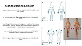 Manifestaciones clínicas
Aparece aproximadamente 1 mes después de la infestación inicial
con el ácaro.
El síntoma cardinal es el prurito, especialmente intenso por la
noche.
Los hallazgos físicos incluyen madrigueras, pápulas eritematosas,
excoriaciones, nódulos, lesiones vesiculopustulosas o ampollosas,
eczematización e infección bacteriana secundaria.
La extensión de la erupción es extremadamente variable y los
hallazgos cutáneos pueden ser muy sutiles
La madriguera típica es un tracto serpiginoso que mide 1 cm de
largo.
 