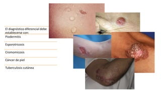El diagnóstico diferencial debe
establecerse con:
Piodermitis
Esporotricosis
Cromomicosis
Cáncer de piel
Tuberculosis cutánea
 