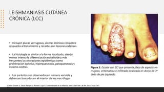 LEISHMANIASIS CUTÁNEA
CRÓNICA (LCC)
• Incluyen placas verrugosas, úlceras crónicas con pobre
respuesta al tratamiento y recaídas con lesiones extensas
• La histología es similar a la forma localizada, siendo
menos intensa la diferenciación epitelioide y más
frecuentes las alteraciones epidérmicas como
proliferación epitelial, hiperqueratosis, paraqueratosis y
escamo-costras.
• Los parásitos son observados en número variable y
deben ser buscados en el interior de los macrófagos
(Castro Grüber S, Zerpa Rangel O, Rondón Lugo A. Leishmaniasis en la infancia. Med Cutan Iber Lat Am 2003; 31(6): 351-
361)
 