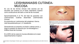 LEISHMANIASIS CUTÁNEA-
MUCOSA
Es una de las formas clínicas más severas por las
secuelas que produce en el tracto respiratorio superior
como consecuencia del daño a nivel de las mucosas.
Aproximadamente 5 al 7% del total de pacientes con
Leishmaniasis Cutánea desarrollan Leishmaniasis
mucosa
Es producida por Leishmanias del subgénero Vianna,
más frecuentemente por L.V. braziliensis.
Generalmente se presenta una lesión cutánea previa, y
luego el parásito se disemina por vía hematógena o
linfática hacia las mucosas
En el 90% de los casos la mucosa afectada es la nasal,
específicamente el septum
(Castro Grüber S, Zerpa Rangel O, Rondón Lugo A. Leishmaniasis en la infancia. Med Cutan Iber Lat Am 2003; 31(6): 351-
361)
 