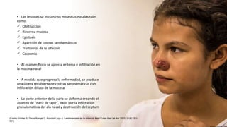 • Las lesiones se inician con molestias nasales tales
como:
 Obstrucción
 Rinorrea mucosa
 Epistaxis
 Aparición de costras serohemáticas
 Trastornos de la olfación
 Cacosmia
• Al examen físico se aprecia eritema e infiltración en
la mucosa nasal
• A medida que progresa la enfermedad, se produce
una úlcera recubierta de costras serohemáticas con
infiltración difusa de la mucosa
• La parte anterior de la nariz se deforma creando el
aspecto de “nariz de tapir”, dado por la infiltración
granulomatosa del ala nasal y destrucción del septum
(Castro Grüber S, Zerpa Rangel O, Rondón Lugo A. Leishmaniasis en la infancia. Med Cutan Iber Lat Am 2003; 31(6): 351-
361)
 