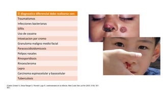El diagnostico diferencial debe realizarse con:
Traumatismos
Infecciones bacterianas
Sifilis
Uso de cocaina
Intoxicacion por cromo
Granuloma maligno medio facial
Paracoccidioidomicosis
Polipos nasales
Rinosporidiosis
Rinoescleroma
Lepra
Carcinoma espinocelular y basocelular
Tuberculosis
(Castro Grüber S, Zerpa Rangel O, Rondón Lugo A. Leishmaniasis en la infancia. Med Cutan Iber Lat Am 2003; 31(6): 351-
361)
 