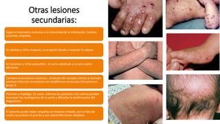 Otras lesiones
secundarias:
Según el momento evolutivo o la intensidad de la infestación: Costras,
escamas, ampollas.
En adultos y niños mayores, la erupción tiende a respetar la cabeza.
En lactantes y niños pequeños: el cuero cabelludo y la cara suelen
afectarse.
Cambios eczematosos extensos: producto del rascado crónico a menudo
produce Infección secundaria con estafilococo aureusy/o Estreptococo
grupo A
Pústulas e impétigo: En casos crónicos las pústulas y las costras pueden
oscurecer las madrigueras de la sarna y dificultar la confirmación del
diagnóstico.
El lactante puede haber ampollas se muestra irritable, por la falta de
sueño secundario al prurito y con sobreinfecciones añadidas
 