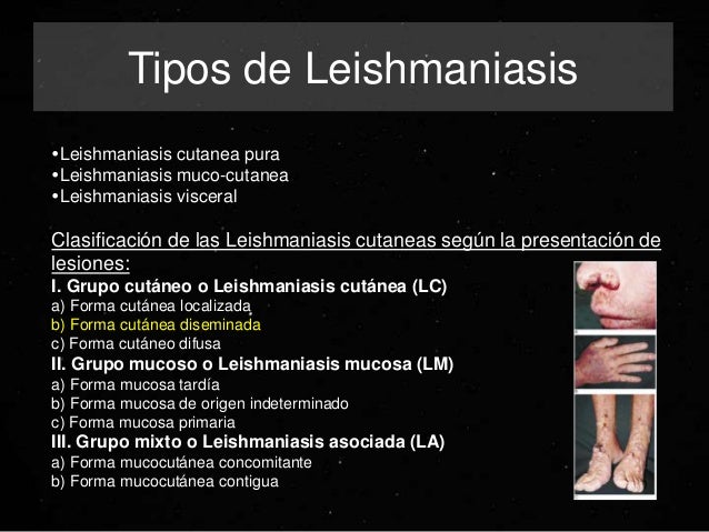 Leishmaniasis cutanea diseminada Leishmaniasis cutanea diseminada