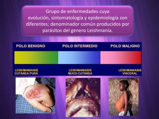 Grupo de enfermedades cuya
 evolución, sintomatología y epidemiología son
diferentes; denominador común producidos por
        parásitos del genero Leishmania.
 