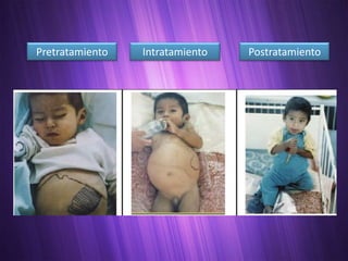 Pretratamiento   Intratamiento   Postratamiento
 