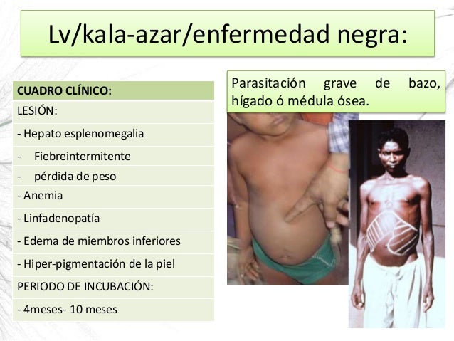 El jugo del limón de las manchas de pigmento las revocaciones