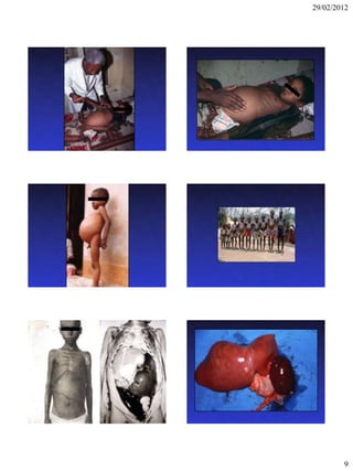 29/02/2012




        9
 