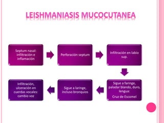 Septum nasal:
infiltración e
inflamación
Perforación septum
Infiltración en labio
sup.
Sigue a faringe,
paladar blando, duro,
lengua:
Cruz de Escomel
Sigue a laringe,
incluso bronquios
Infiltración,
ulceración en
cuerdas vocales:
cambio voz
 