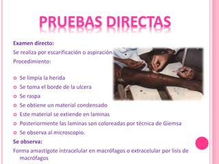 Examen directo:
Se realiza por escarificación o aspiración.
Procedimiento:
 Se limpia la herida
 Se toma el borde de la ulcera
 Se raspa
 Se obtiene un material condensado
 Este material se extiende en laminas
 Posteriormente las laminas son coloreadas por técnica de Giemsa
 Se observa al microscopio.
Se observa:
Forma amastigote intracelular en macrófagos o extracelular por lisis de
macrófagos
 