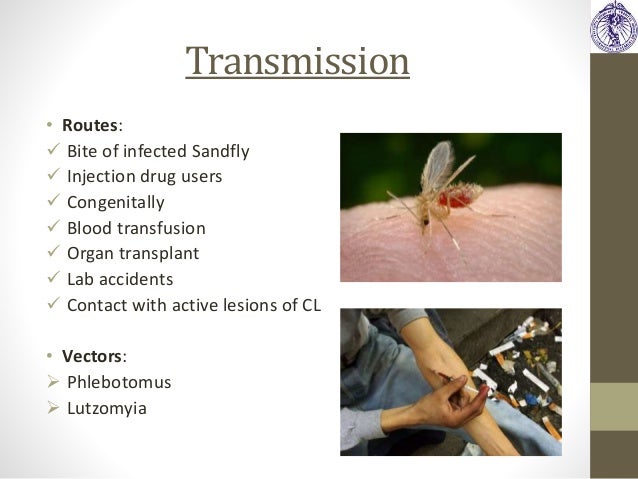 treatment skin kolkata Diagnosis Treatment Strategies Current in of & Leishmaniasis