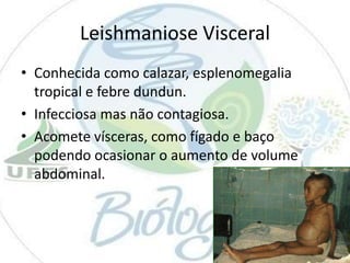 Leishmaniose Visceral
• Conhecida como calazar, esplenomegalia
tropical e febre dundun.
• Infecciosa mas não contagiosa.
• Acomete vísceras, como fígado e baço
podendo ocasionar o aumento de volume
abdominal.

 