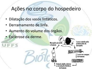Ações no corpo do hospedeiro
•
•
•
•

Dilatação dos vasos linfáticos.
Derramamento de linfa.
Aumento do volume dos órgãos.
Esclerose da derme.

 