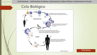 Ciclo Biológico
Erick Bruno
Leishmaniose - Leishmaniose Cutânea, Leishmaniose Cutânea Difusa e Leishmaniose Visceral
 