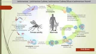 Erick Bruno
Leishmaniose - Leishmaniose Cutânea, Leishmaniose Cutânea Difusa e Leishmaniose Visceral
 