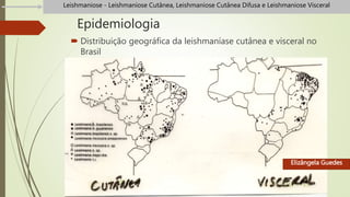 Epidemiologia
 Distribuição geográfica da leishmaníase cutânea e visceral no
Brasil
Elizângela Guedes
Leishmaniose - Leishmaniose Cutânea, Leishmaniose Cutânea Difusa e Leishmaniose Visceral
 