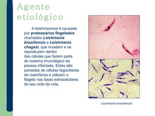 Leishmania brasiliensis   Agente etiológico A leishmaniose é causada por  protozoários flagelados  chamados  Leishmania brasiliensis  e  Leishmania chagasi , que invadem e se reproduzem dentro das células que fazem parte do sistema imunológico da pessoa infectada. Estes são  parasitas de células fagocitárias de mamíferos e utilizam o flagelo nas fases extracelulares do seu ciclo de vida. 