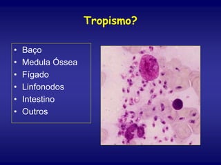 Tropismo?
• Baço
• Medula Óssea
• Fígado
• Linfonodos
• Intestino
• Outros
 