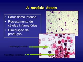 A medula óssea
• Parasitismo intenso
• Recrutamento de
células inflamatórias
• Diminuição da
produção
Macrófago parasitado
Macrófago rompido
 
