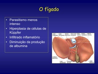 O fígado
• Parasitismo menos
intenso
• Hiperplasia de células de
Küppfer
• Infiltrado inflamatório
• Diminuição da produção
de albumina
 