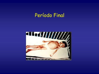 Período Final
 