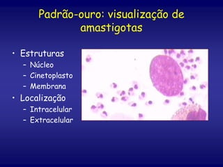 Padrão-ouro: visualização de
amastigotas
• Estruturas
– Núcleo
– Cinetoplasto
– Membrana
• Localização
– Intracelular
– Extracelular
 