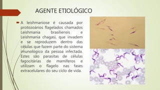 AGENTE ETIOLÓGICO
 A leishmaniose é causada por
protozoários flagelados chamados
Leishmania brasiliensis e
Leishmania chagasi, que invadem
e se reproduzem dentro das
células que fazem parte do sistema
imunológico da pessoa infectada.
Estes são parasitas de células
fagocitárias de mamíferos e
utilizam o flagelo nas fases
extracelulares do seu ciclo de vida.
 
