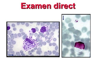 Examen direct
Examen direct
 