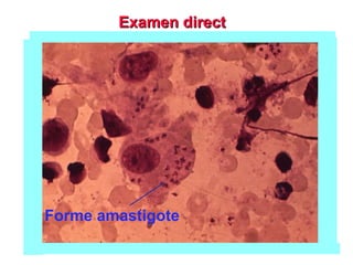 Examen direct
Examen direct
Forme amastigote
 