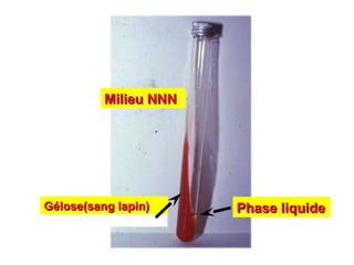 Milieu NNN




Gélose(sang lapin)     Phase liquide
 
