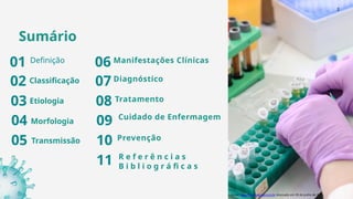 Sumário
Definição
Classificação
Fonte: www.brasilescolar.com.br Acessado em 30 de junho de 2025.
2
01
02
03
04
05
Etiologia
Morfologia
Transmissão
06
07
08
09
10
Manifestações Clínicas
Diagnóstico
Tratamento
Cuidado de Enfermagem
Prevenção
R e f e r ê n c i a s
B i b l i o g r á fi c a s
11
 